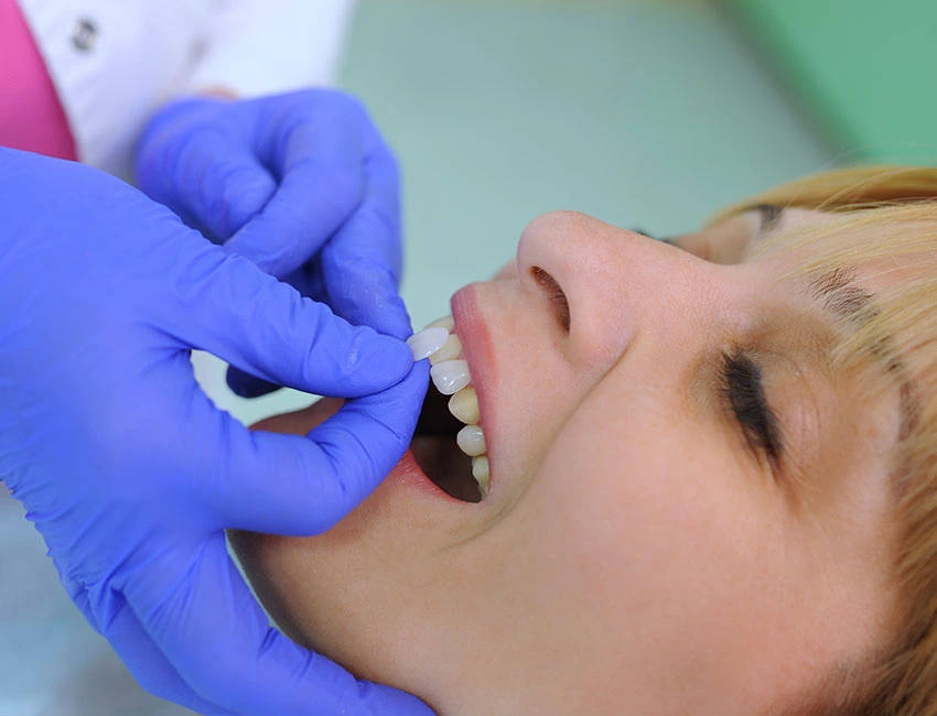 Thinking You Want Veneers? Here's Where to Begin — Wildomar Smiles Dentistry