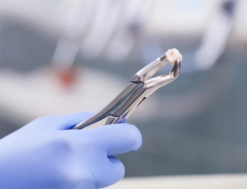 Safe, Comfortable, and Stress-Free Tooth Extractions in Wildomar, CA — Wildomar Smiles Dentistry