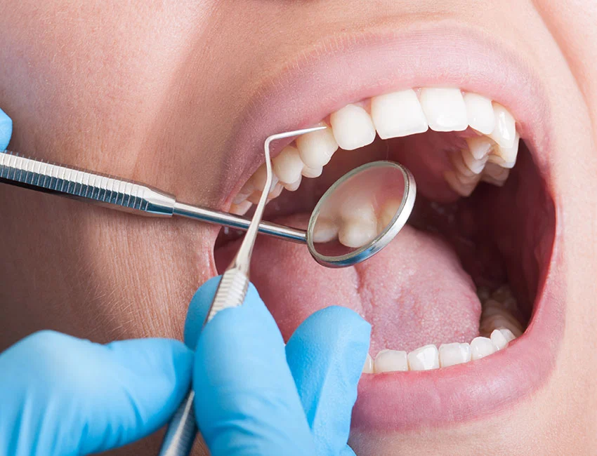 Teeth Cleaning at Wildomar Smiles Dentistry