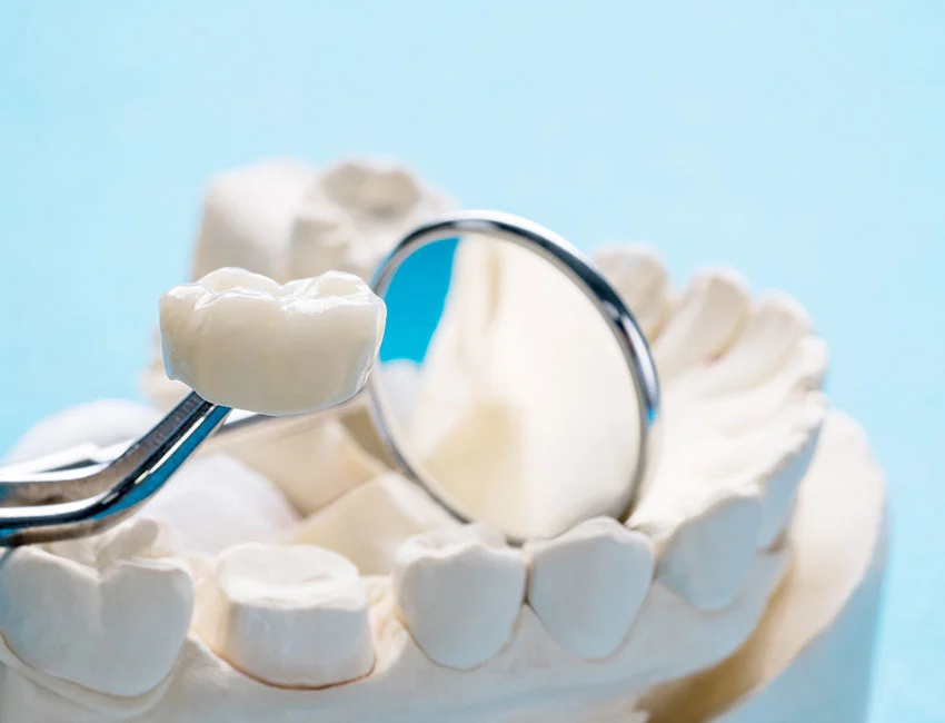 Same-Day Crowns in Wildomar: How Digital Dentistry Revolutionizes Same-Day Treatment — Wildomar Smiles Dentistry