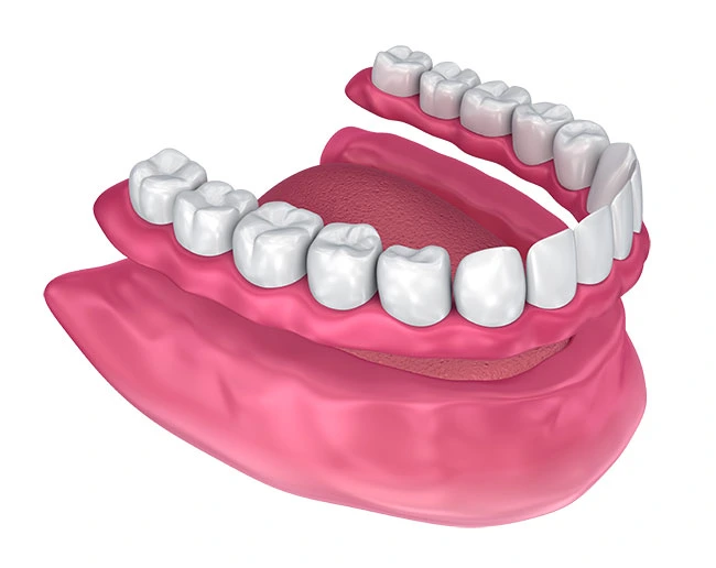 A full upper and lower denture